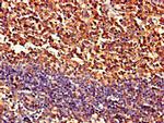 PIPOX Polyclonal Antibody