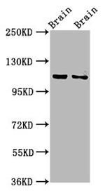 CLIP2 Antibody in Western Blot (WB)