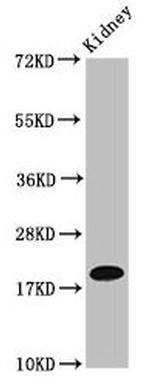 NAA38 Antibody in Western Blot (WB)