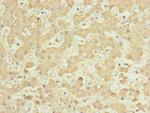 NUF2 Antibody in Immunohistochemistry (Paraffin) (IHC (P))
