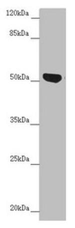NUF2 Antibody in Western Blot (WB)