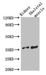 SLC25A32 Polyclonal Antibody