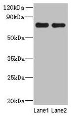 ACTR8 Polyclonal Antibody