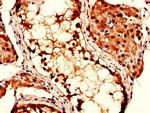 CSN7b Antibody in Immunohistochemistry (Paraffin) (IHC (P))