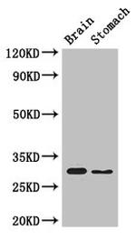 CSN7b Antibody in Western Blot (WB)