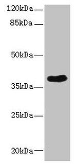 CAB39L Antibody in Western Blot (WB)