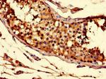 SLC52A3 Antibody in Immunohistochemistry (Paraffin) (IHC (P))