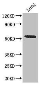 SLC52A3 Antibody in Western Blot (WB)