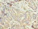 TUBG2 Polyclonal Antibody
