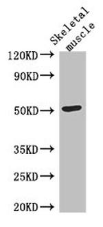 TUBG2 Antibody in Western Blot (WB)