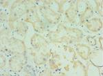 TMOD3 Polyclonal Antibody