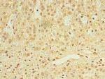 UTP23 Polyclonal Antibody
