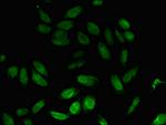 NPL Polyclonal Antibody