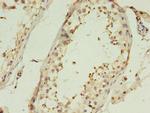 CTRP6 Antibody in Immunohistochemistry (Paraffin) (IHC (P))