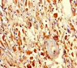 F1142 Polyclonal Antibody
