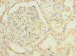 TMEM38B Antibody in Immunohistochemistry (Paraffin) (IHC (P))