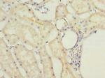 MRPL22 Antibody in Immunohistochemistry (Paraffin) (IHC (P))