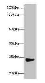 MRPL22 Antibody in Western Blot (WB)
