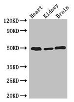 ANKRD10 Antibody in Western Blot (WB)