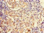 MAP10 Antibody in Immunohistochemistry (Paraffin) (IHC (P))