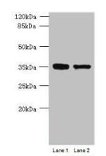 C20orf72 Antibody in Western Blot (WB)