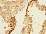 NTM Antibody in Immunohistochemistry (Paraffin) (IHC (P))