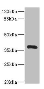 NTM Antibody in Western Blot (WB)