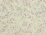 CIPC Antibody in Immunohistochemistry (Paraffin) (IHC (P))