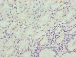 CIPC Polyclonal Antibody