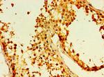 EDA2R Antibody in Immunohistochemistry (Paraffin) (IHC (P))