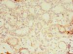 KBTBD4 Polyclonal Antibody