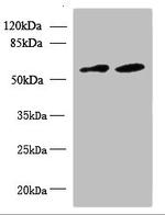 KBTBD4 Antibody in Western Blot (WB)