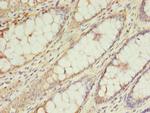 TRSPAP1 Antibody in Immunohistochemistry (Paraffin) (IHC (P))