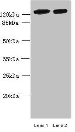 MCM9 Polyclonal Antibody