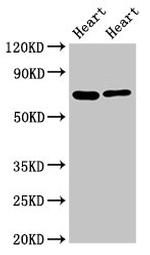 FASTKD2 Antibody in Western Blot (WB)