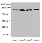 FLRT3 Antibody in Western Blot (WB)