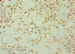 DKK4 Polyclonal Antibody