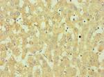DKK4 Antibody in Immunohistochemistry (Paraffin) (IHC (P))