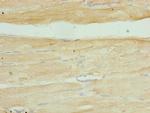 SERTAD1 Antibody in Immunohistochemistry (Paraffin) (IHC (P))