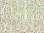 SERTAD1 Polyclonal Antibody