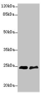SERTAD1 Antibody in Western Blot (WB)