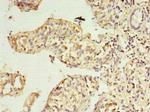 RWDD2A Polyclonal Antibody