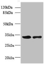 RWDD2A Antibody in Western Blot (WB)