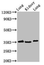 HOXD1 Antibody in Western Blot (WB)