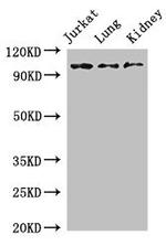 SMARCAL1 Antibody in Western Blot (WB)
