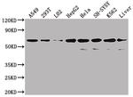 SLC23A1 Antibody in Western Blot (WB)