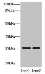 NDFIP1 Antibody in Western Blot (WB)
