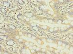 NUPL1 Polyclonal Antibody