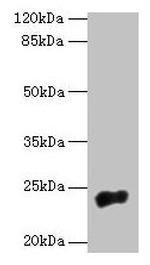NACA2 Polyclonal Antibody