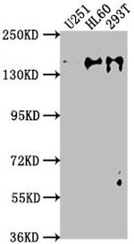 ADNP Antibody in Western Blot (WB)